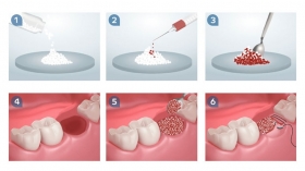 EASY HANDLING - DITTA FACCHINI